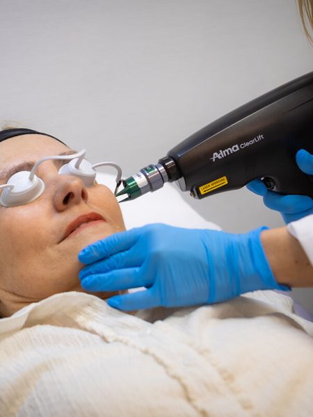 Tratamiento Elektra Clearlift by Alma Laser