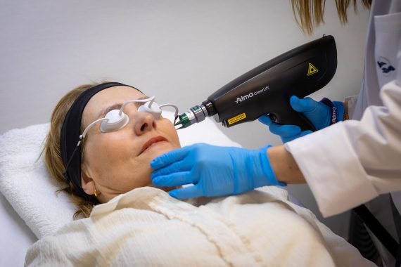 Tratamiento Elektra Clearlift by Alma Laser